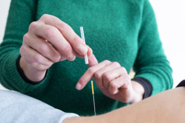 Fysiotherapie Nancy Burger, Vlissingen, dry-needling, kinesio, hardloopblessures, mulligan, McKenzie